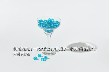 我的甜酒吃了一次然后放了幾天發(fā)了一小塊的霉在表面請問剩下的還