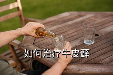 如何治療牛皮蘚